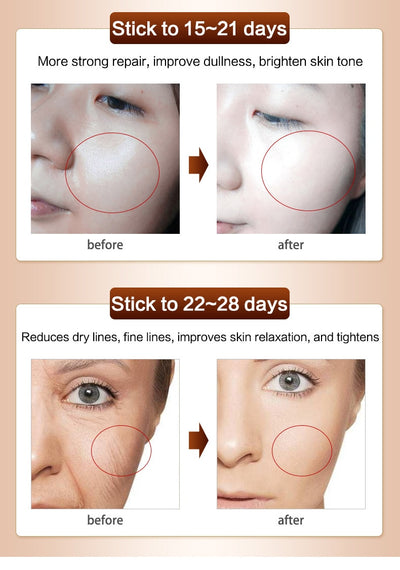 Anti Aging Wrinkle Remover Face Cream